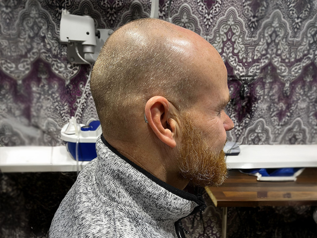 Read more about the article A Gift of Hearing & Mr Dean Williams’ Journey Back to Clarity