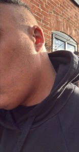 Mr Dominic Kane with his hearing aids.