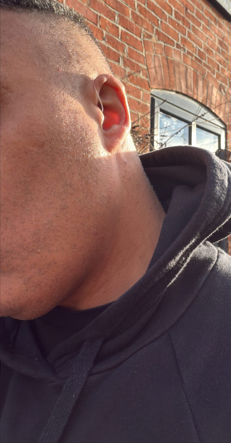 Mr Dominic Kane with his hearing aids.