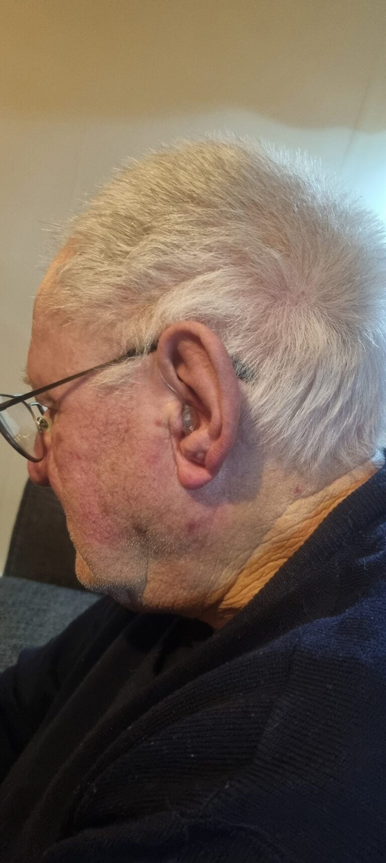 Mr Brian Sands with his hearing aids for better hearing.